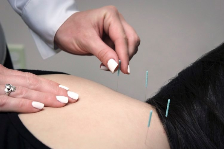acupuncture_DrKennedy